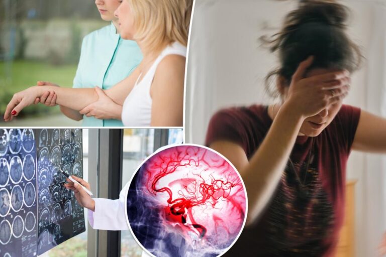 Strokes are common - here's how to prevent most of them

