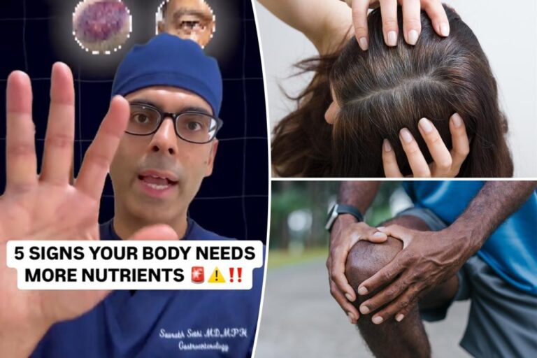 I'm a doctor - here are 5 signs your body needs more nutrients

