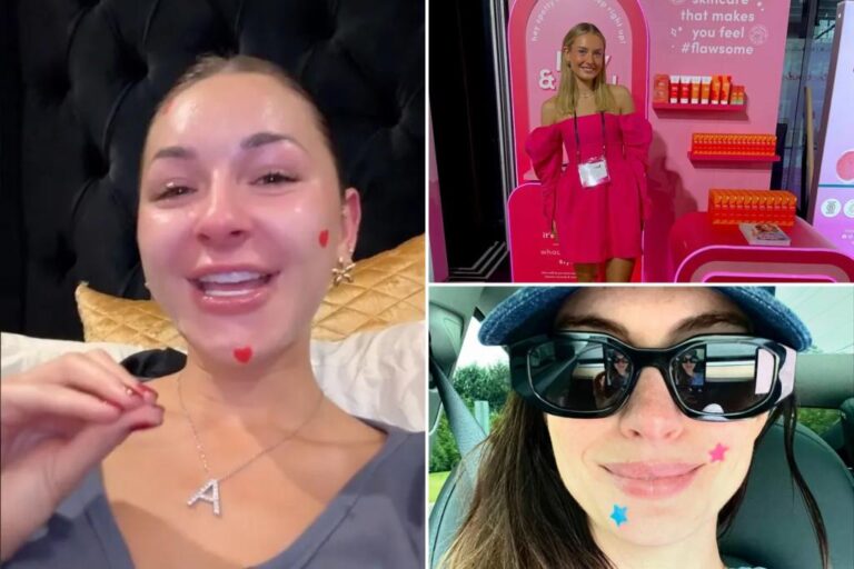 Gen Z is trying to make acne 'cool' in latest trend: 'We don't need to hide our blemishes anymore'

